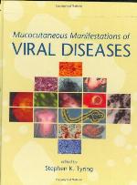 Mucocutaneous Manifestations of Viral Diseases