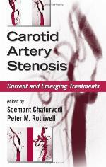 Carotid Artery Stenosis