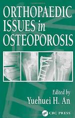 Orthopaedic Issues in Osteoporosis