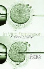 In Vitro Fertilization