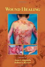 Wound Healing