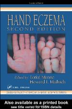 Hand Eczema
