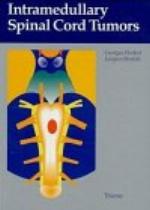 Intramedullary Spinal Cord Tumors