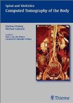 Spiral and Multislice Computed Tomography of the Body