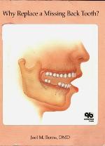 Why Replace A Missing Back Tooth?