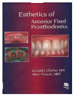 Esthetics of Anterior Fixed Prosthodontics