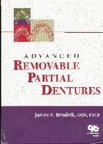 Advanced Removable Partial Dentures