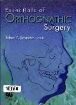 Essentials of Orthognathic Surgery