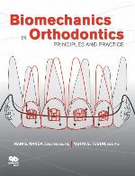 Biomechanics in Orthodontics