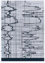 Handbook of Log Evaluation Techniques for Carbonate Reservoirs (Methods in Exploration Series)