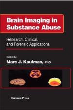 Brain Imaging in Substance Abuse: Research, Clinical, and Forensic Applications (Forensic Science and Medicine)