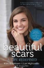 Beautiful Scars