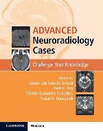 Advanced Neuroradiology Cases