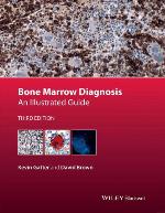 Bone Marrow Diagnosis