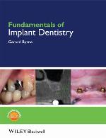 Fundamentals of Implant Dentistry