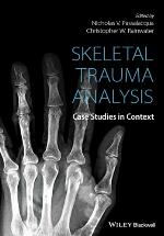 Skeletal Trauma Analysis