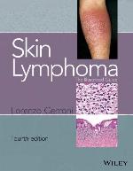 Skin Lymphoma