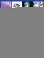 Pituitary Disorders : Diagnosis and Management