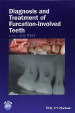 Diagnosis and Treatment of Furcation-Involved Teeth