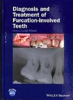 Diagnosis and Treatment of Furcation-Involved Teeth