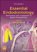 Essential endodontology : prevention and treatment of apical periodontitis