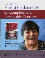 Journal of Prosthodontics on Complete and Removable Dentures