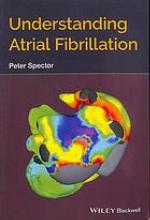 Understanding Atrial Fibrillation