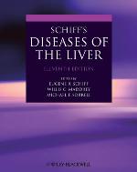 Schiff's diseases of the liver