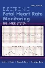 Electronic Fetal Heart Rate Monitoring