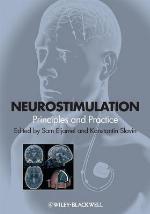 Neurostimulation
