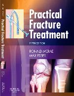 Practical Fracture Treatment.