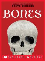 Bones