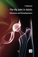 The hip joint in adults : advances and developments