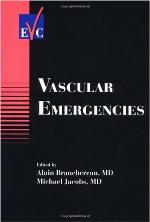 Vascular Emergencies