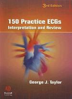 150 Practice Ecgs