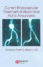 Current Endovascular Treatment of Abdominal Aortic Aneurysms