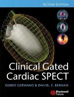Clinical Gated Cardiac SPECT