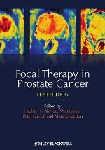 Focal Therapy in Prostate Cancer