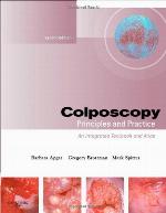 Colposcopy