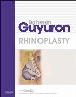 Rhinoplasty