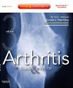 Arthritis In Black And White
