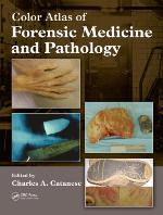 Color Atlas of Forensic Medicine and Pathology