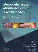 Mucocutaneous Manifestations of Viral Diseases