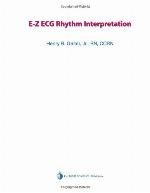 E-Z ECG rhythm interpretation