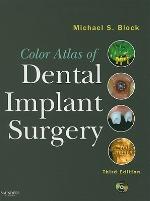 Color Atlas of Dental Implant Surgery