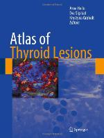 Atlas of Thyroid Lesions