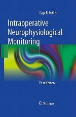 Intraoperative Neurophysiological Monitoring