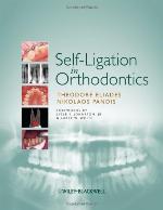 Self-Ligation in Orthodontics