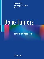Bone Tumors