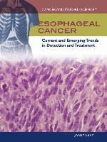 Esophageal Cancer